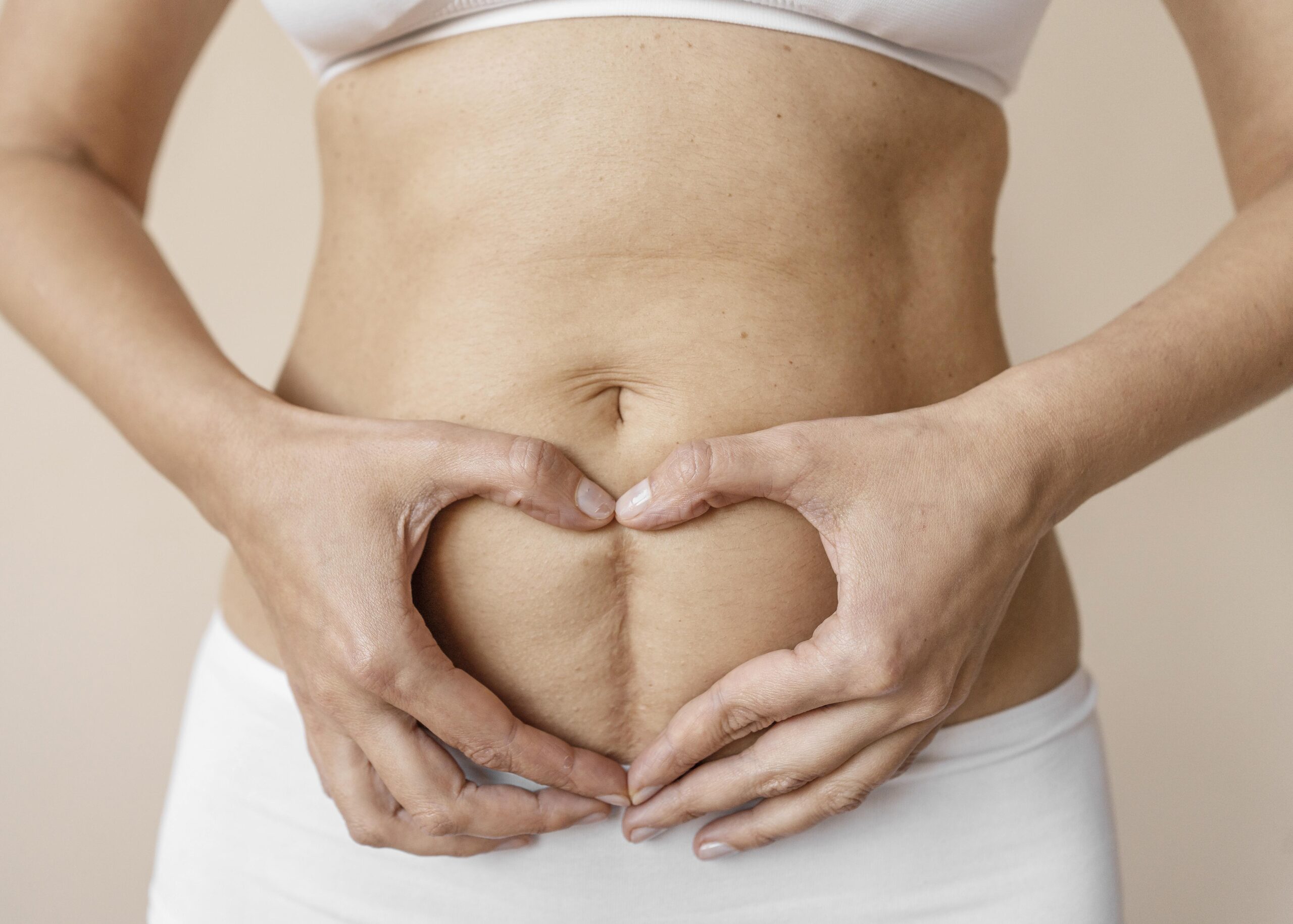 7 Proven Ways to Make Your Vertical C-Section Scar Disappear
